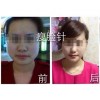 整形美容培训价格如何_【亲情推荐】上海市受欢迎的整形美容培训