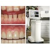 廊坊专业的牙齿满口修复费用格专业的牙齿满口修复