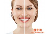 靖江30岁可以做牙齿矫正吗?